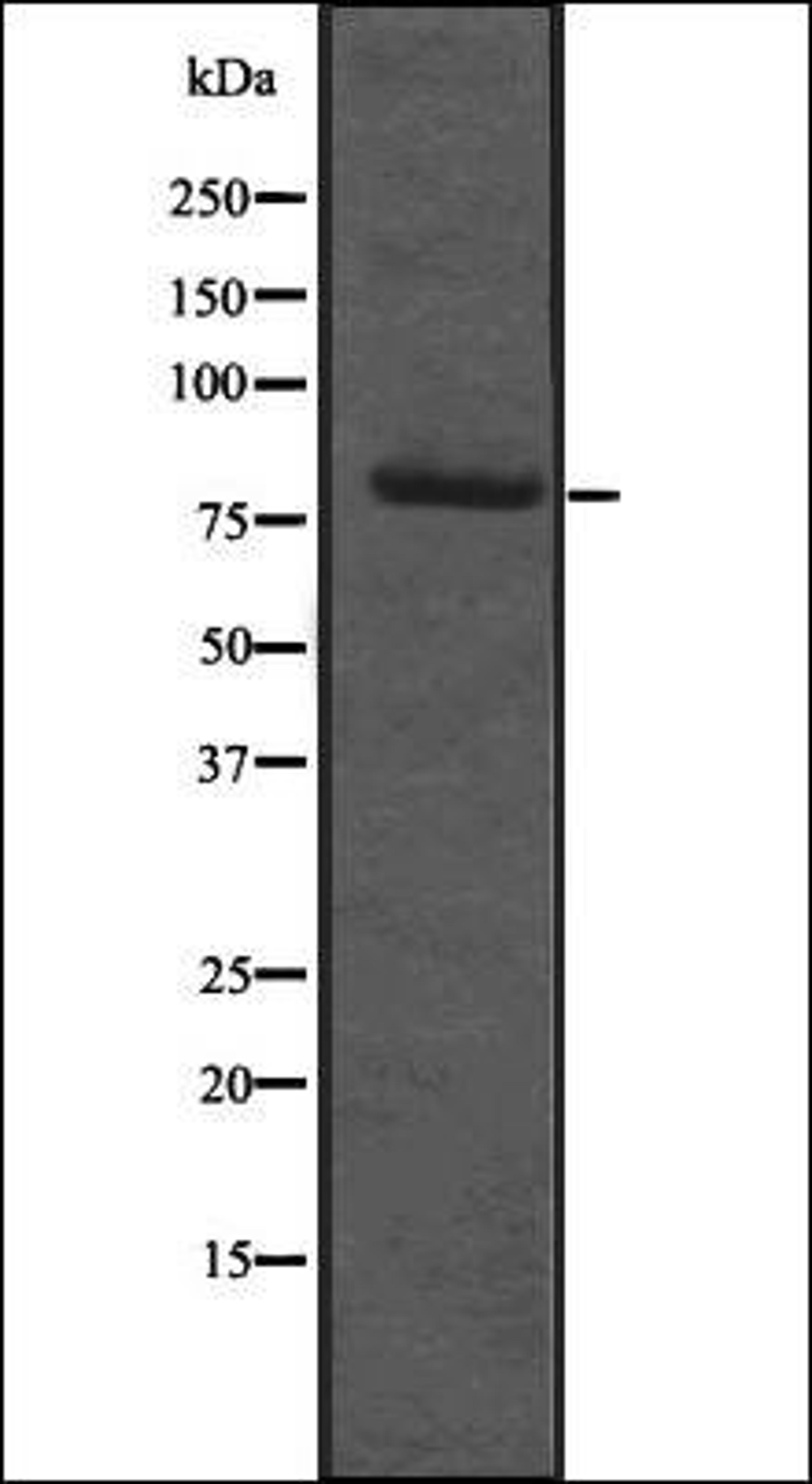 Western blot analysis of Hela cell lysate using RBM35B antibody