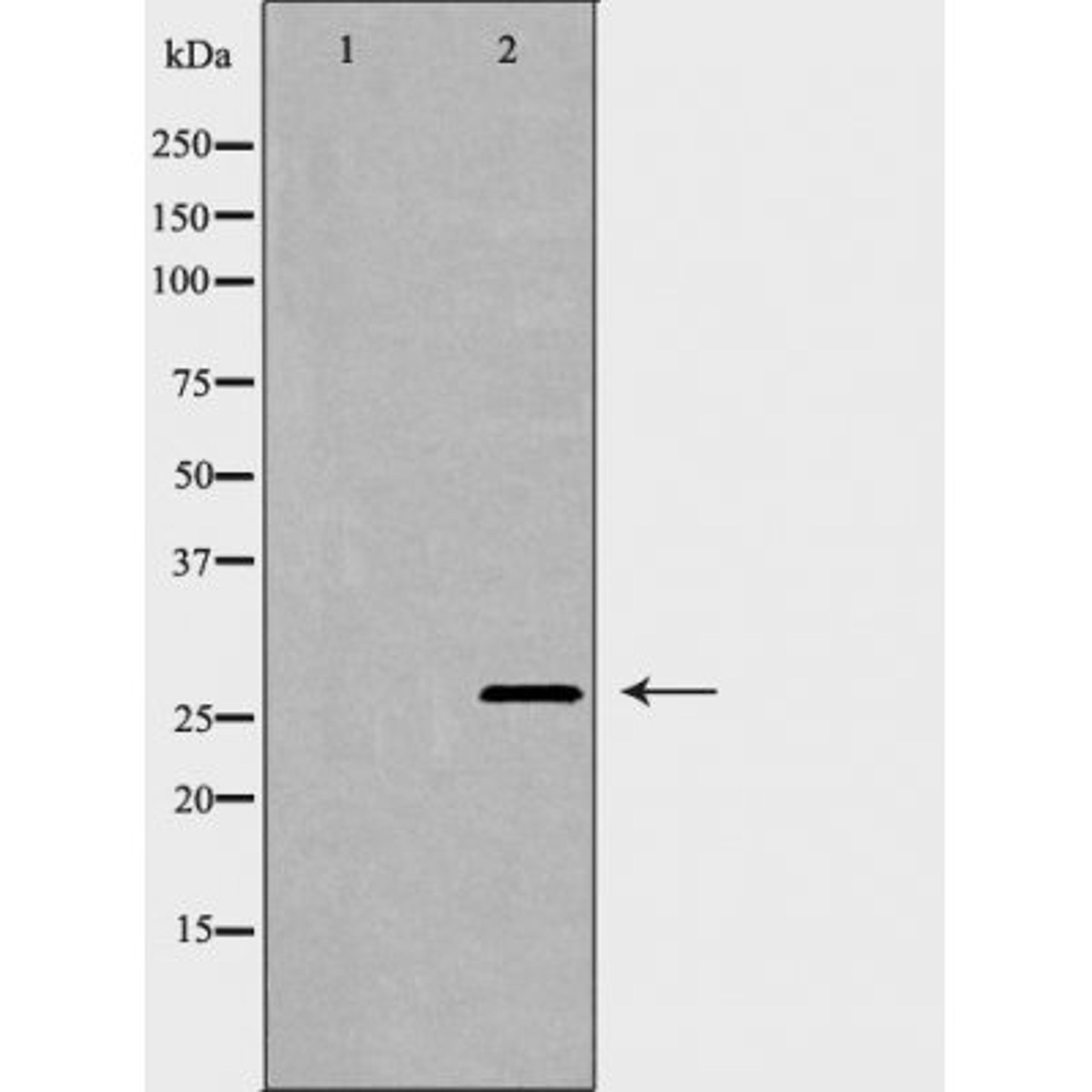 Western blot analysis of human spleen cell lysate using TNFRSF10C antibody