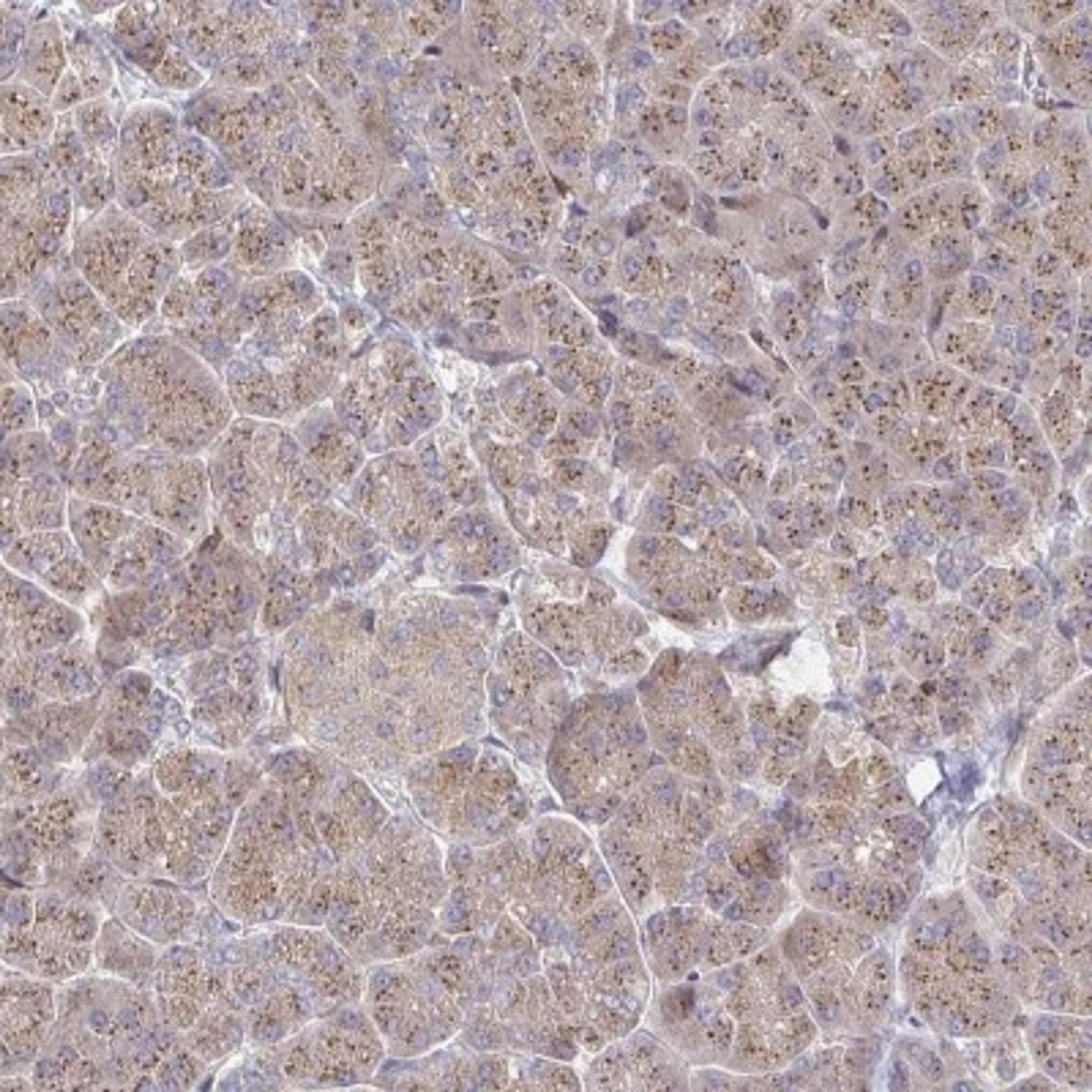 Immunohistochemistry: FRMD3 Antibody [NBP2-33879] - Immunohistochemical staining of human pancreas shows moderate granular cytoplasmic positivity in exocrine glandular cells.