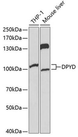 Western blot - DPYD Antibody (A1620)