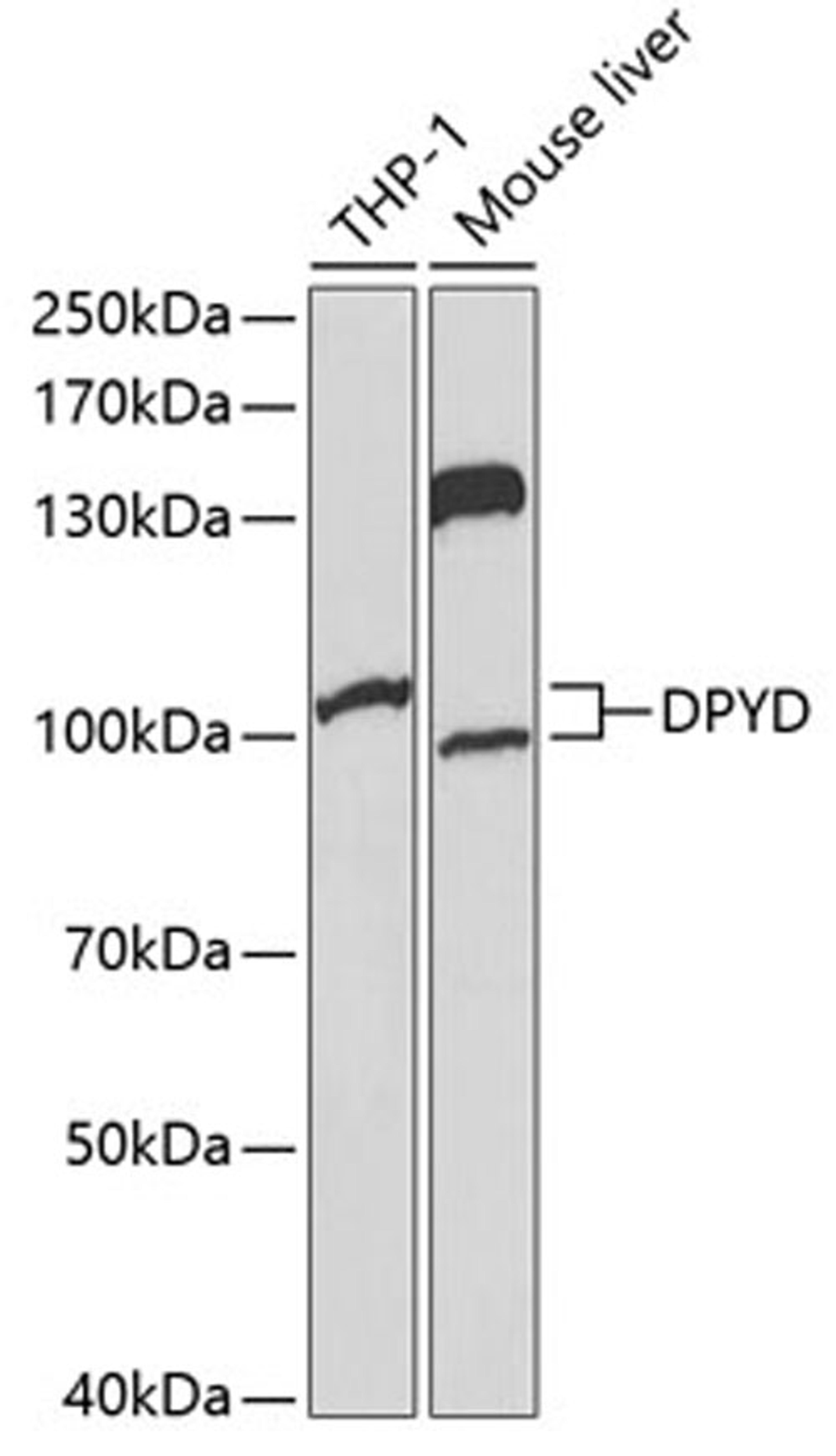 Western blot - DPYD Antibody (A1620)