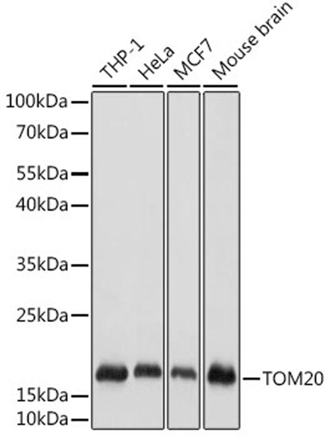 Western blot - TOM20 antibody (A19403)