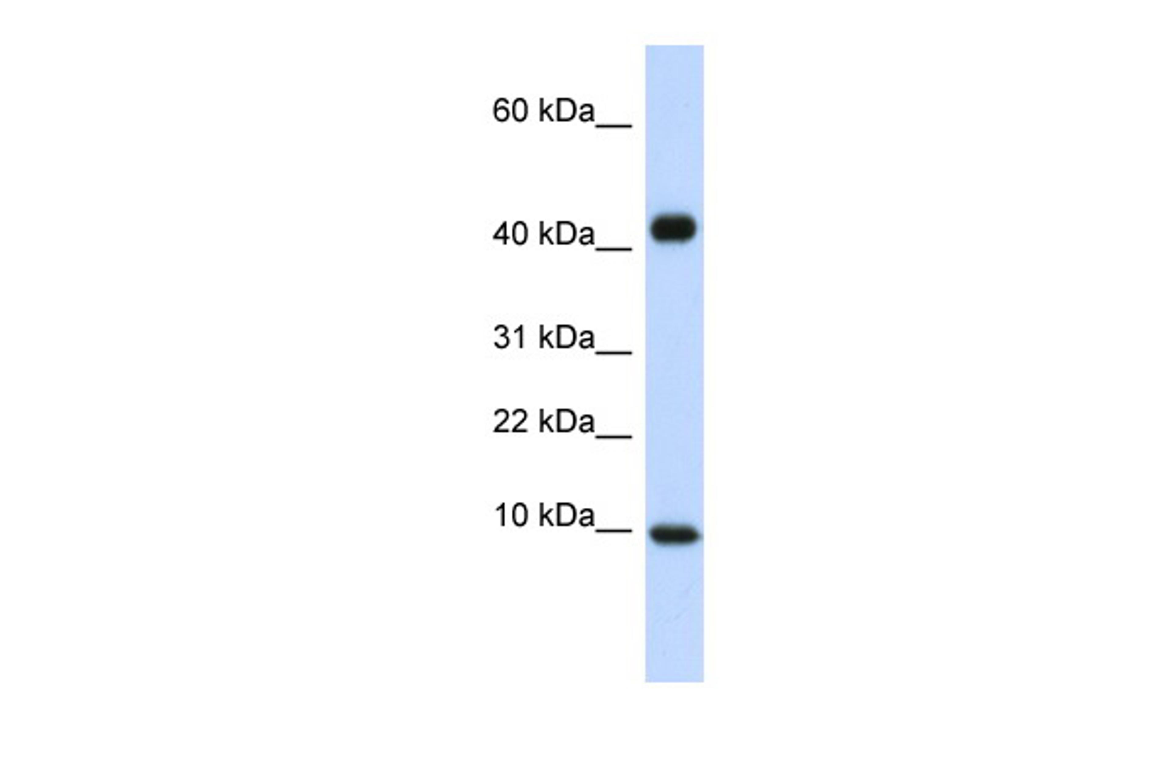 Antibody used in WB on Human Heart at 0.2-1 ug/ml.