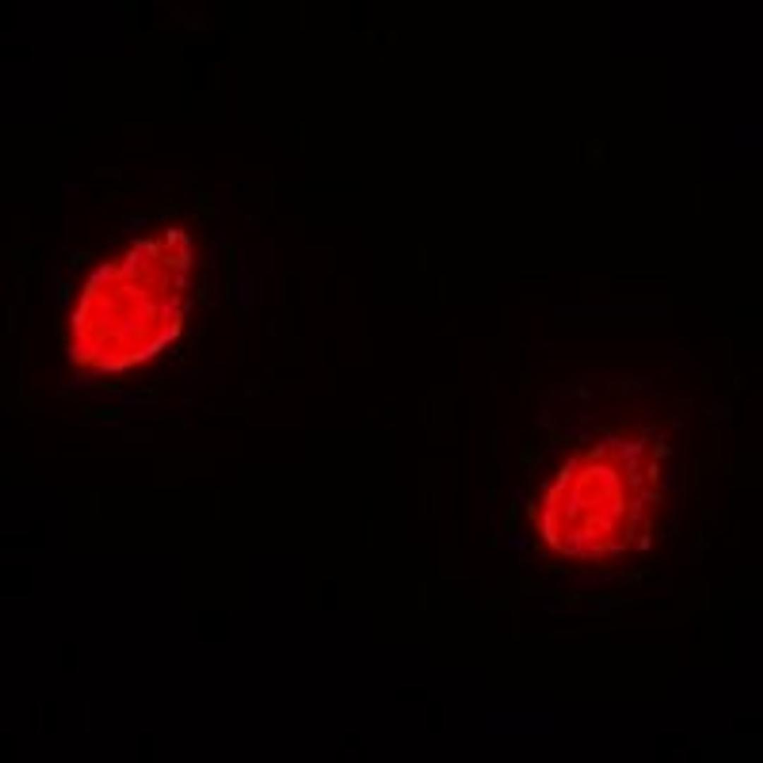 Immunofluorescent analysis of Hela cells using GNB2L1 antibody