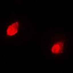 Immunofluorescent analysis of Hela cells using GNB2L1 antibody