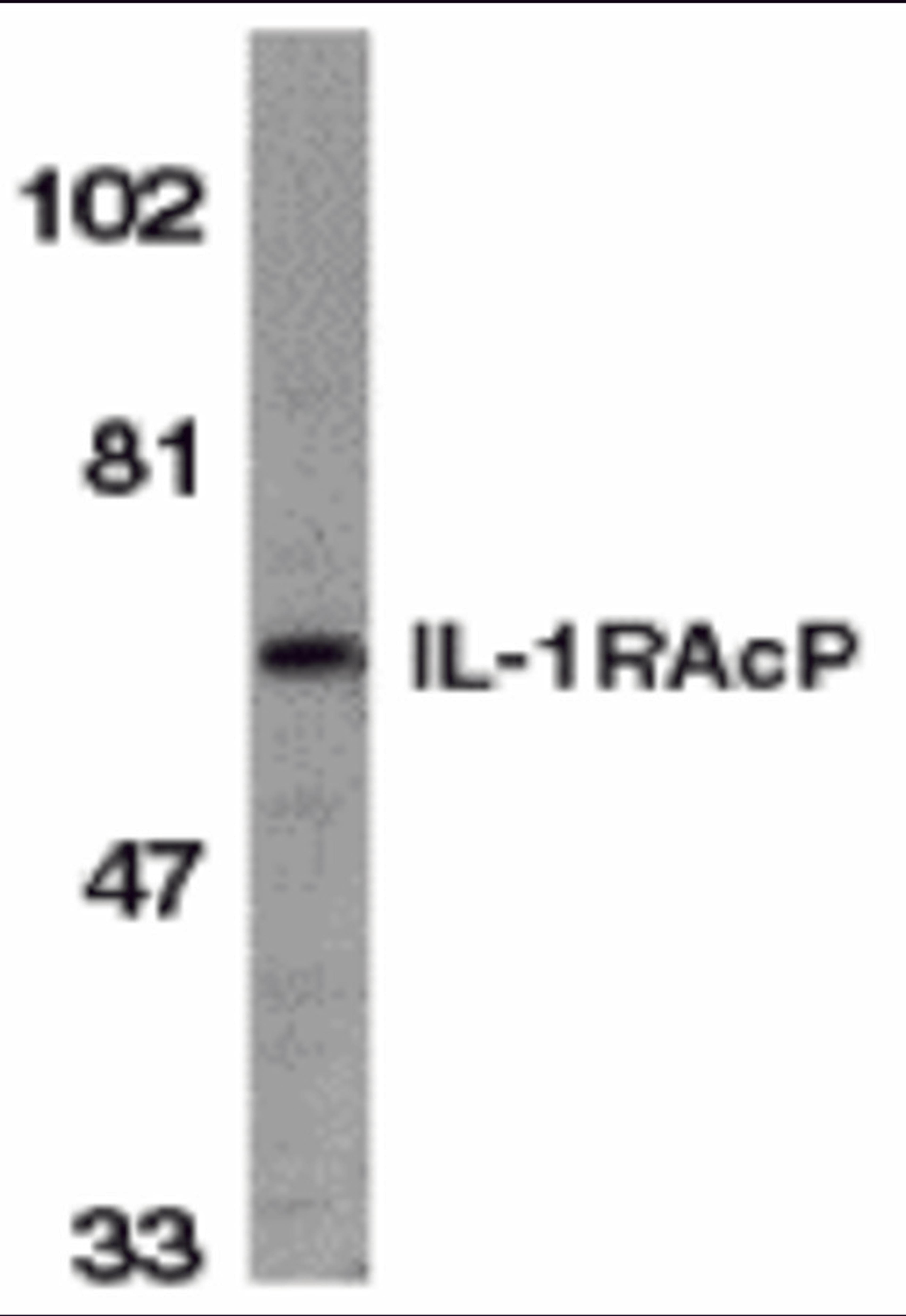 Western blot analysis of IL-1RAcP in HeLa whole cell lysate with IL-1RAcP antibody at 1 μg/mL.