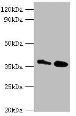 Western blot. All lanes: CTSK antibody at 8ug/ml. Lane 1: MCF-7 whole cell lysate. Lane 2: Rat brain tissue. Secondary. Goat polyclonal to rabbit IgG at 1/10000 dilution. Predicted band size: 37 kDa. Observed band size: 37 kDa. 