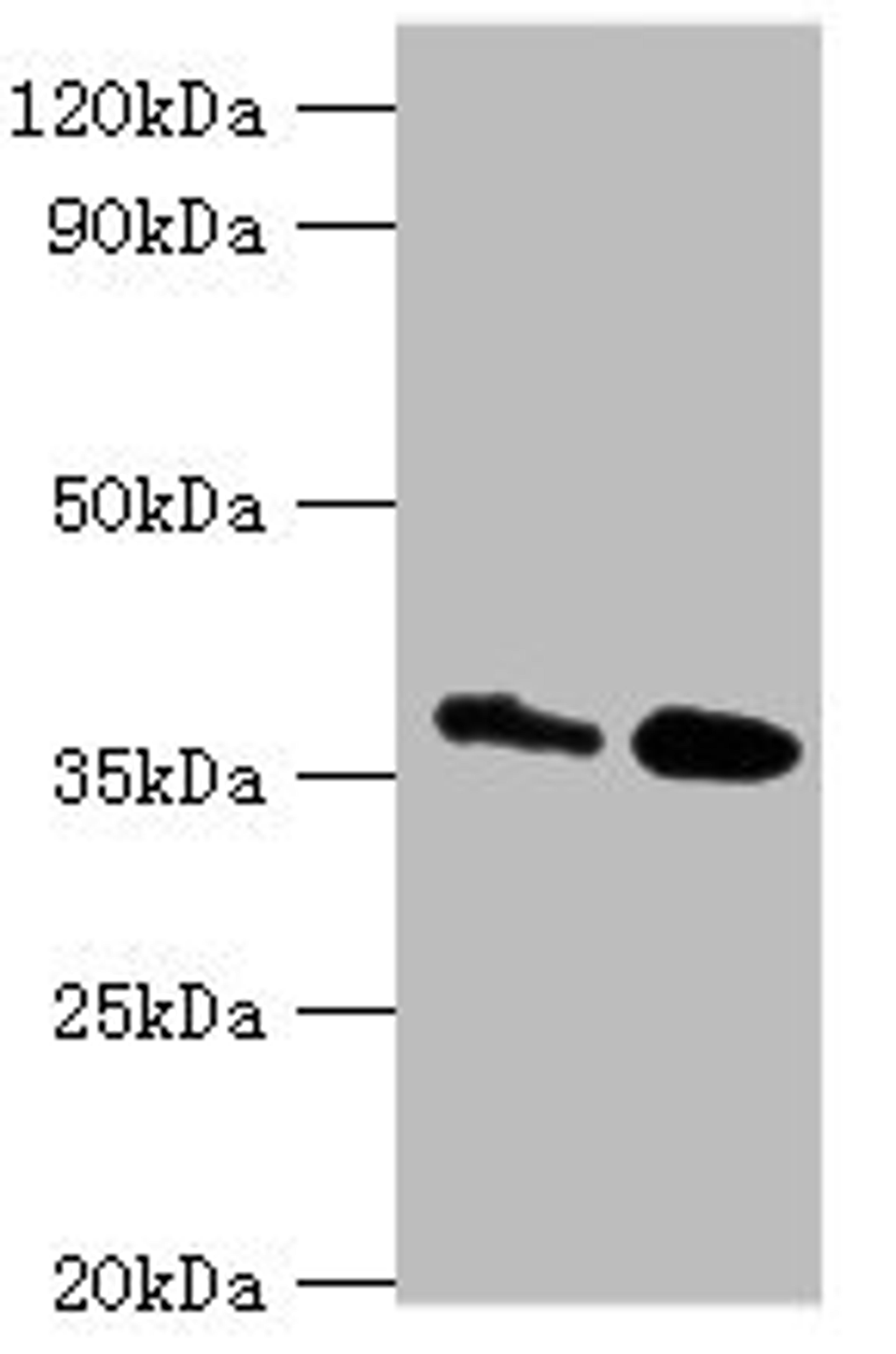 Western blot. All lanes: CTSK antibody at 8ug/ml. Lane 1: MCF-7 whole cell lysate. Lane 2: Rat brain tissue. Secondary. Goat polyclonal to rabbit IgG at 1/10000 dilution. Predicted band size: 37 kDa. Observed band size: 37 kDa. 