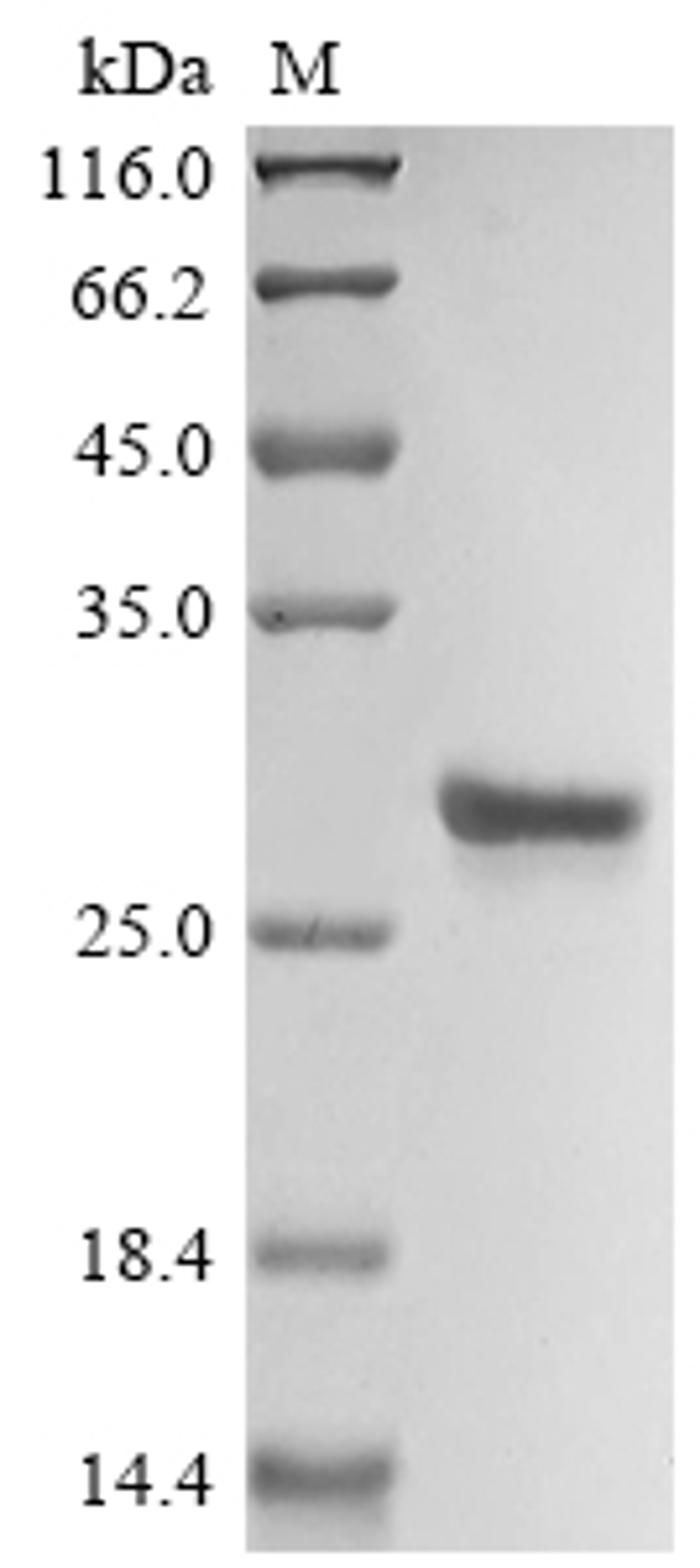 (Tris-Glycine gel) Discontinuous SDS-PAGE (reduced) with 5% enrichment gel and 15% separation gel.