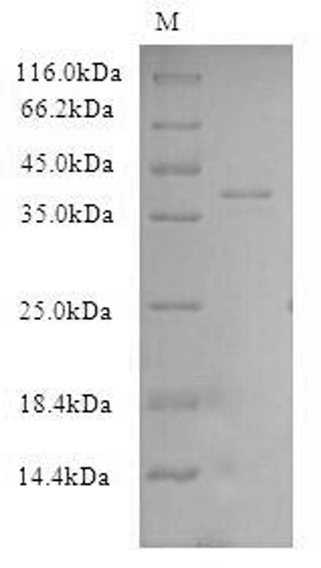(Tris-Glycine gel) Discontinuous SDS-PAGE (reduced) with 5% enrichment gel and 15% separation gel.