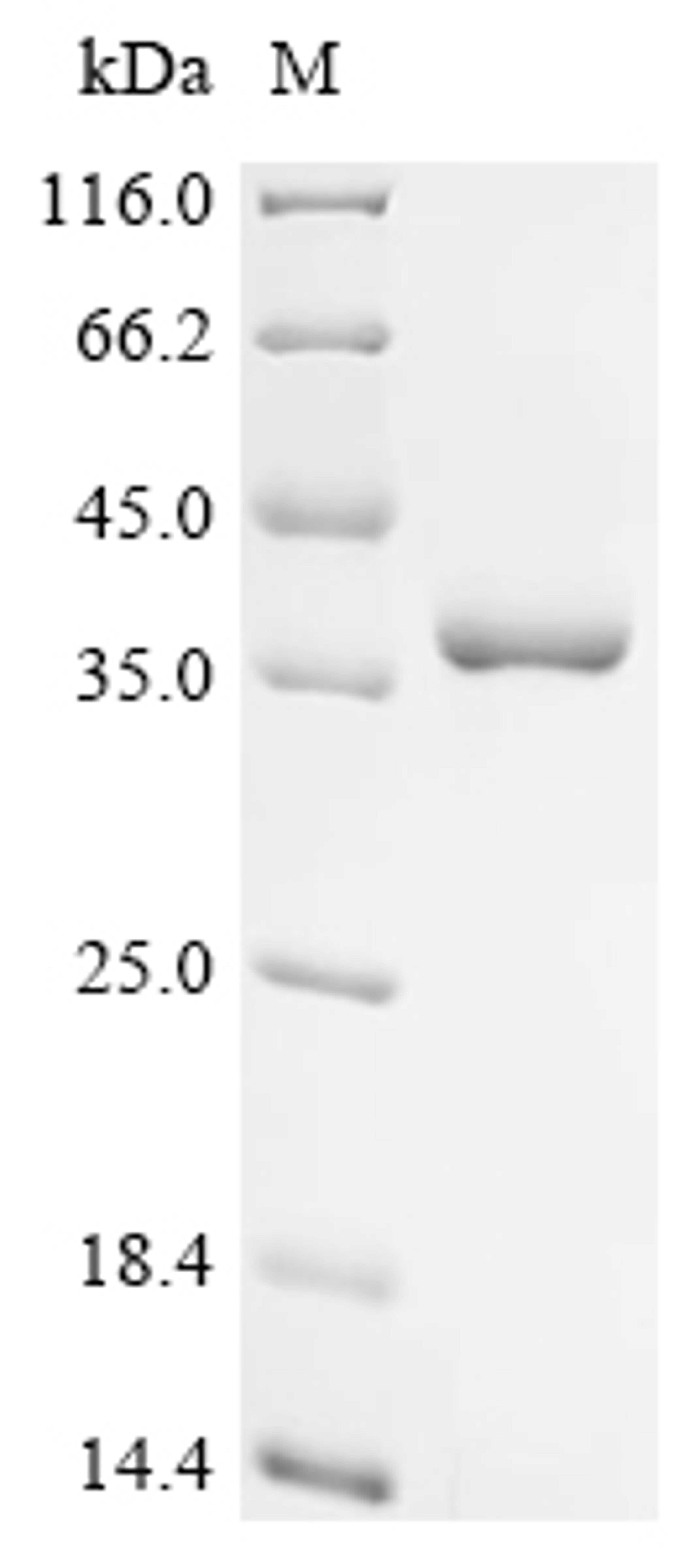 (Tris-Glycine gel) Discontinuous SDS-PAGE (reduced) with 5% enrichment gel and 15% separation gel.