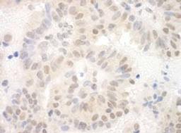 Detection of human SAP130 by immunohistochemistry.