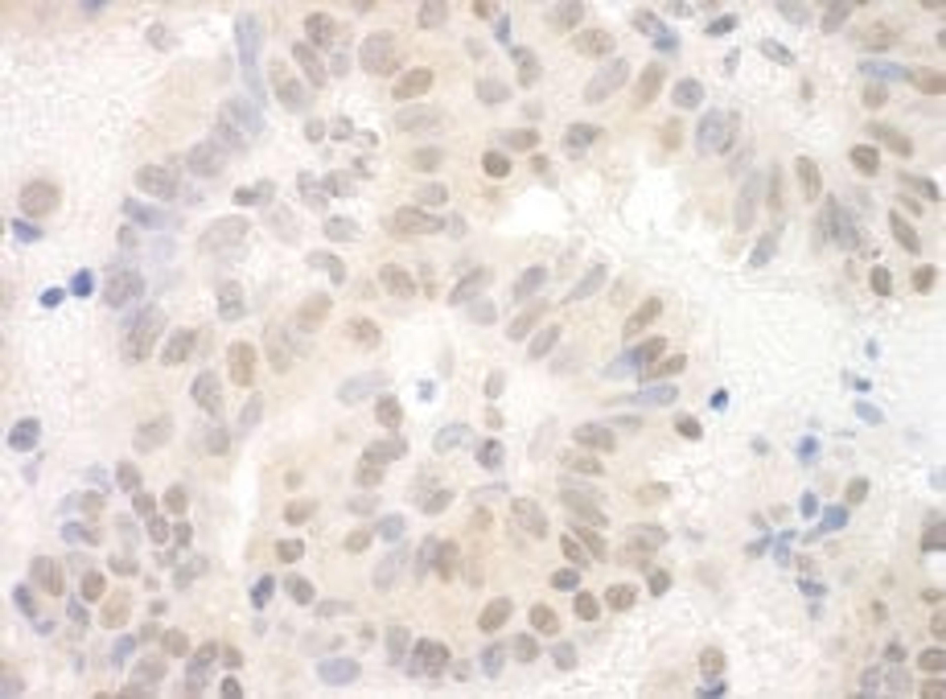 Detection of human SAP130 by immunohistochemistry.