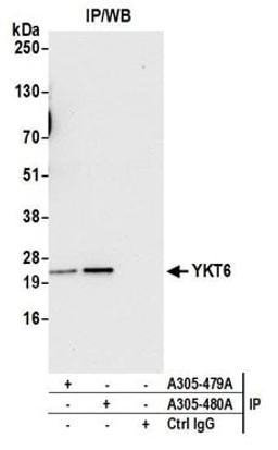 Detection of human YKT6 by western blot of immunoprecipitates.