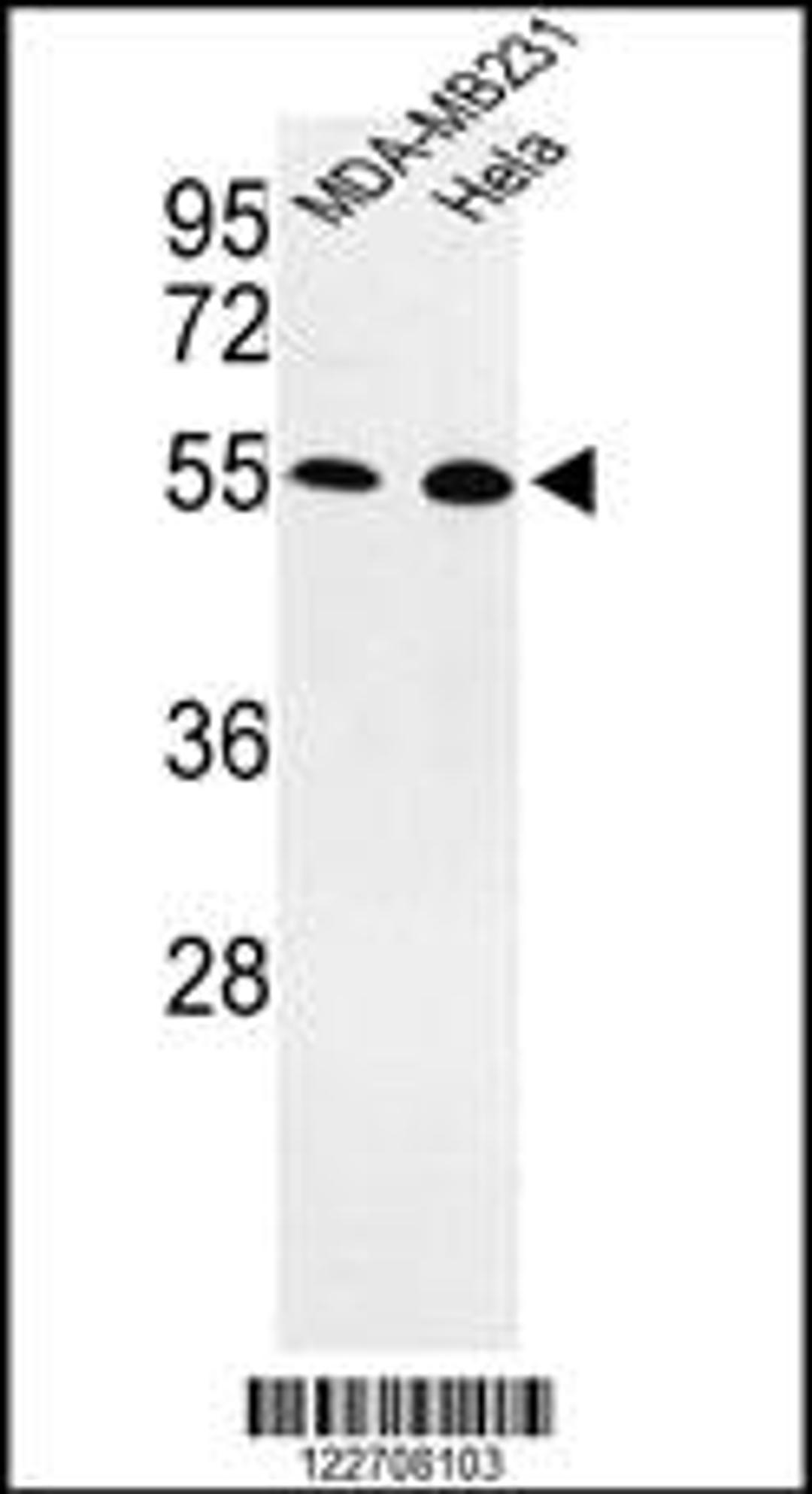 Western blot analysis of EGLN2 Antibody in MDA-MB231, Hela cell line lysates (35ug/lane)