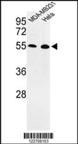 Western blot analysis of EGLN2 Antibody in MDA-MB231, Hela cell line lysates (35ug/lane)