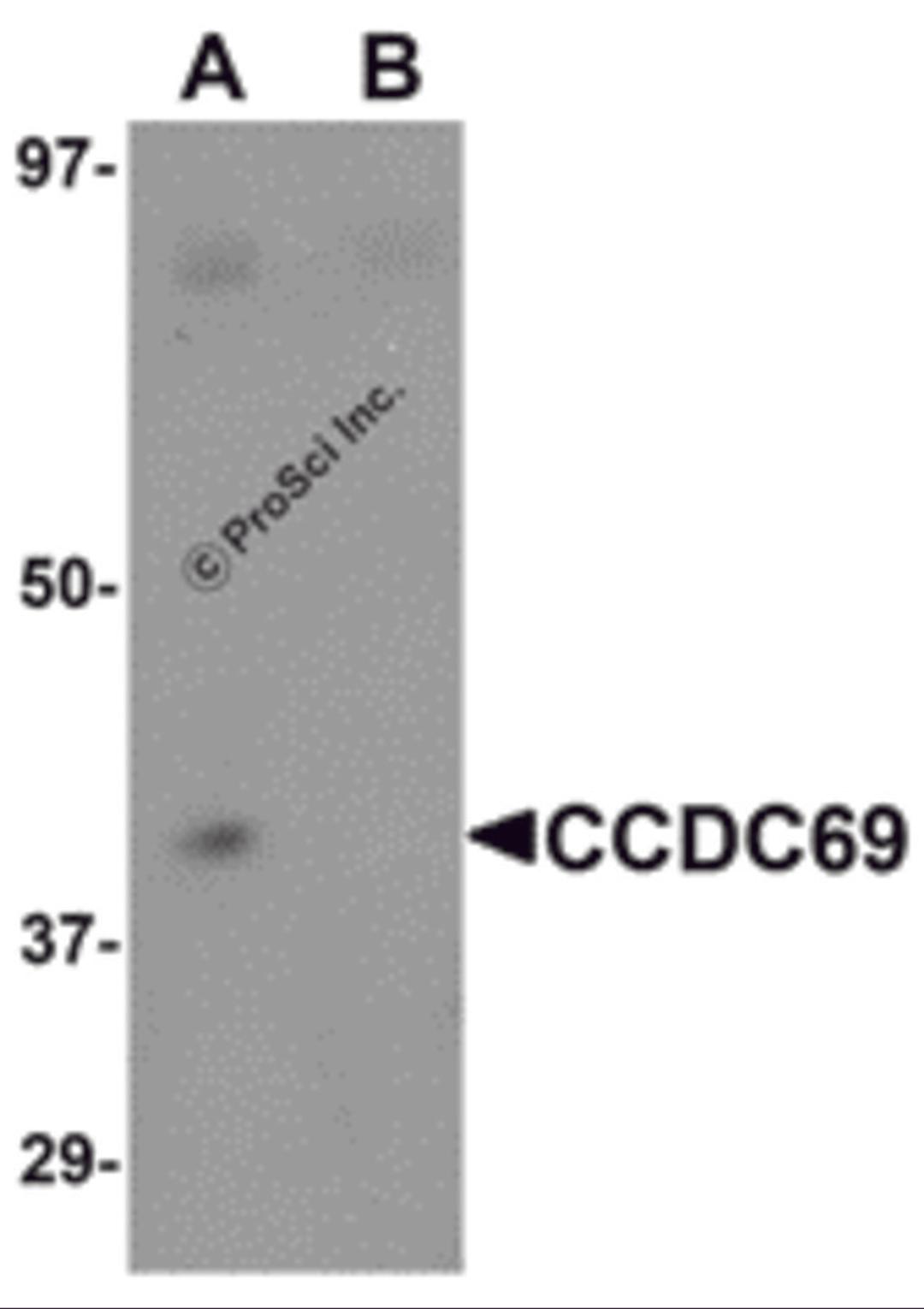 Western blot analysis of CCDC69 in mouse lung tissue lysate with CCDC69 antibody at 1 μg/mL in (A) the absence and (B) the presence of blocking peptide.