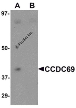 Western blot analysis of CCDC69 in mouse lung tissue lysate with CCDC69 antibody at 1 μg/mL in (A) the absence and (B) the presence of blocking peptide.