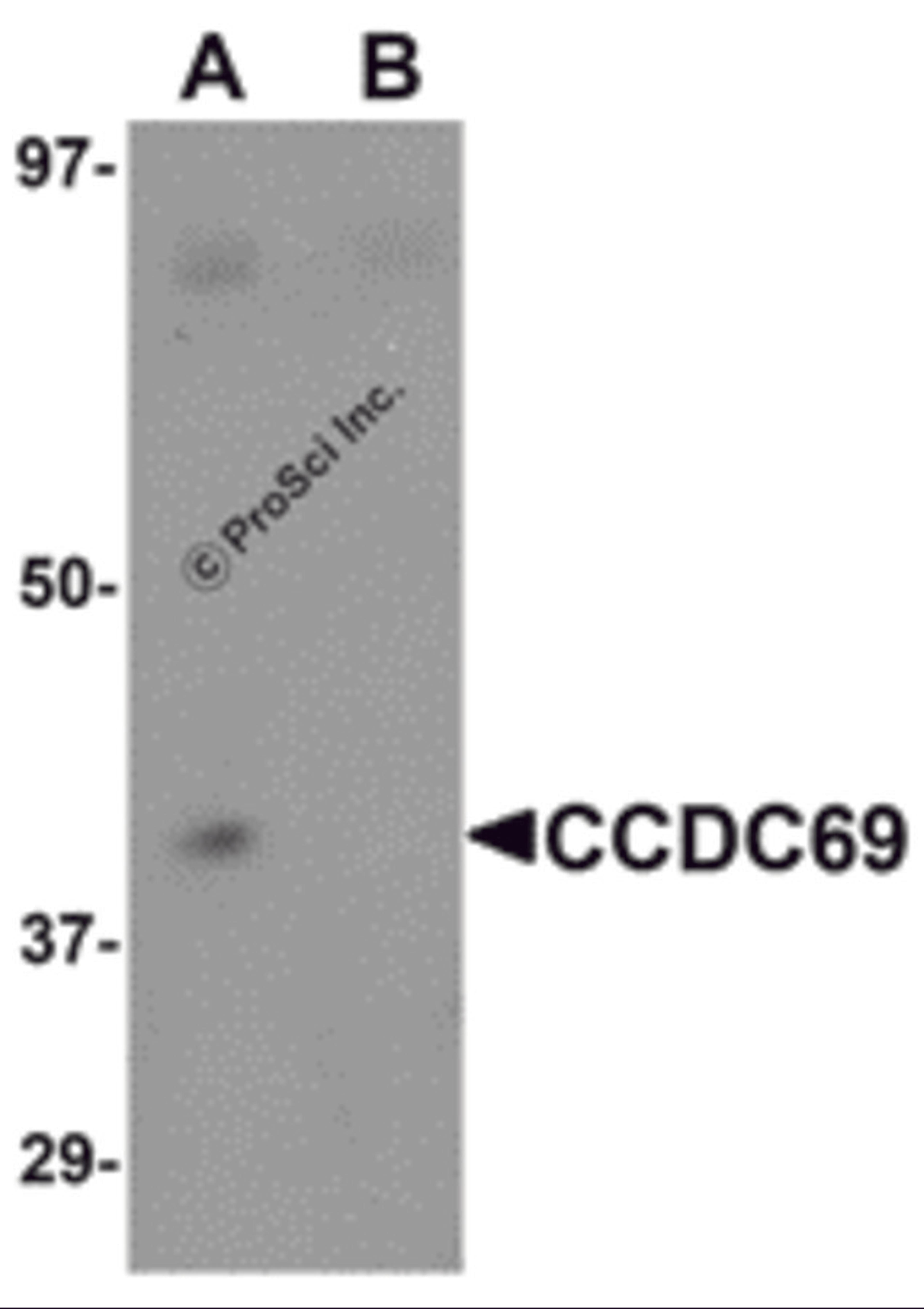 Western blot analysis of CCDC69 in mouse lung tissue lysate with CCDC69 antibody at 1 μg/mL in (A) the absence and (B) the presence of blocking peptide.