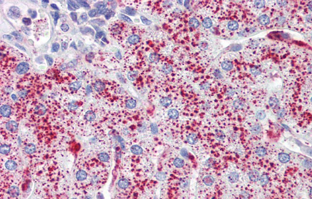 Antibody used in IHC on Human Liver at 5.0 ug/ml.