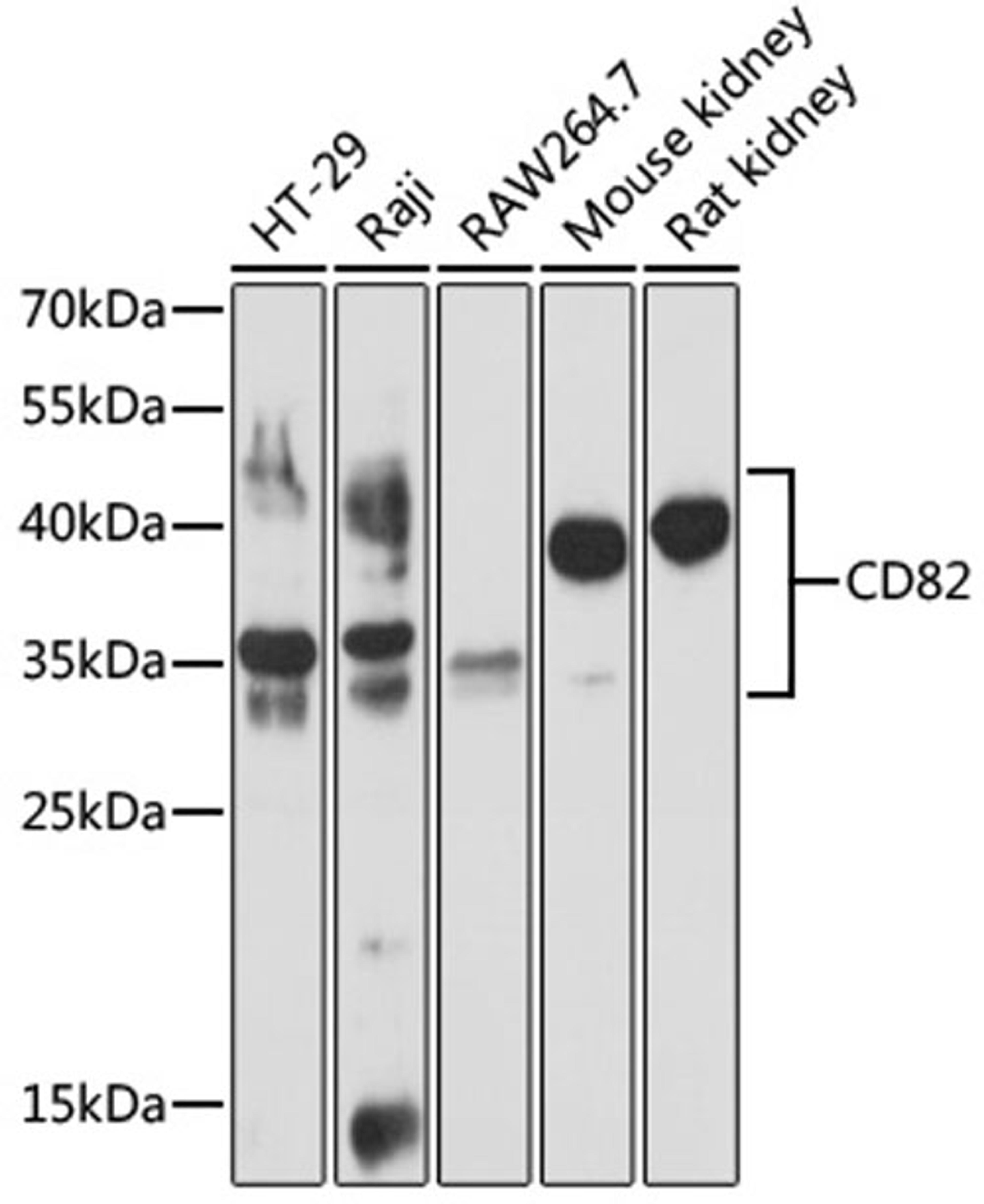 Western blot - CD82 antibody (A1778)