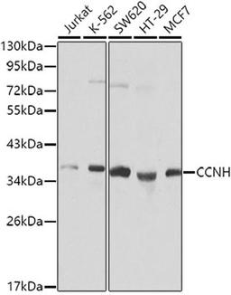 Western blot - CCNH Antibody (A0995)