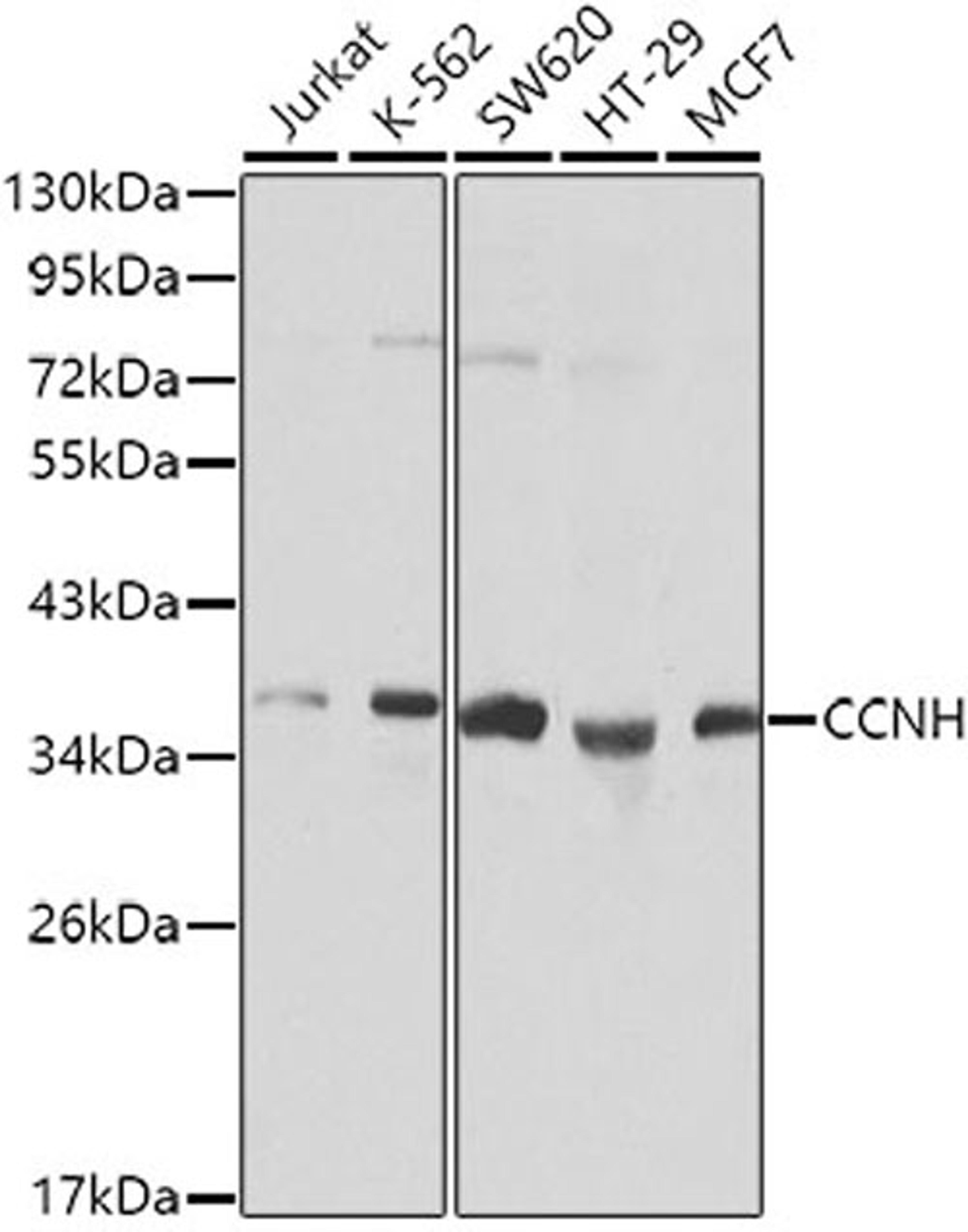 Western blot - CCNH Antibody (A0995)