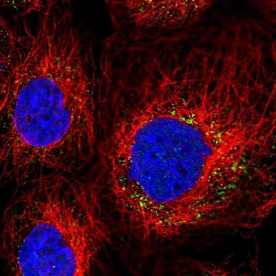 Immunocytochemistry/Immunofluorescence: ACOX3 Antibody [NBP1-85901] - Immunofluorescent staining of human cell line A-431 shows positivity in vesicles.