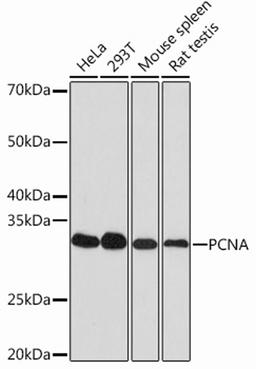 Western blot - PCNA Rabbit mAb (A12427)