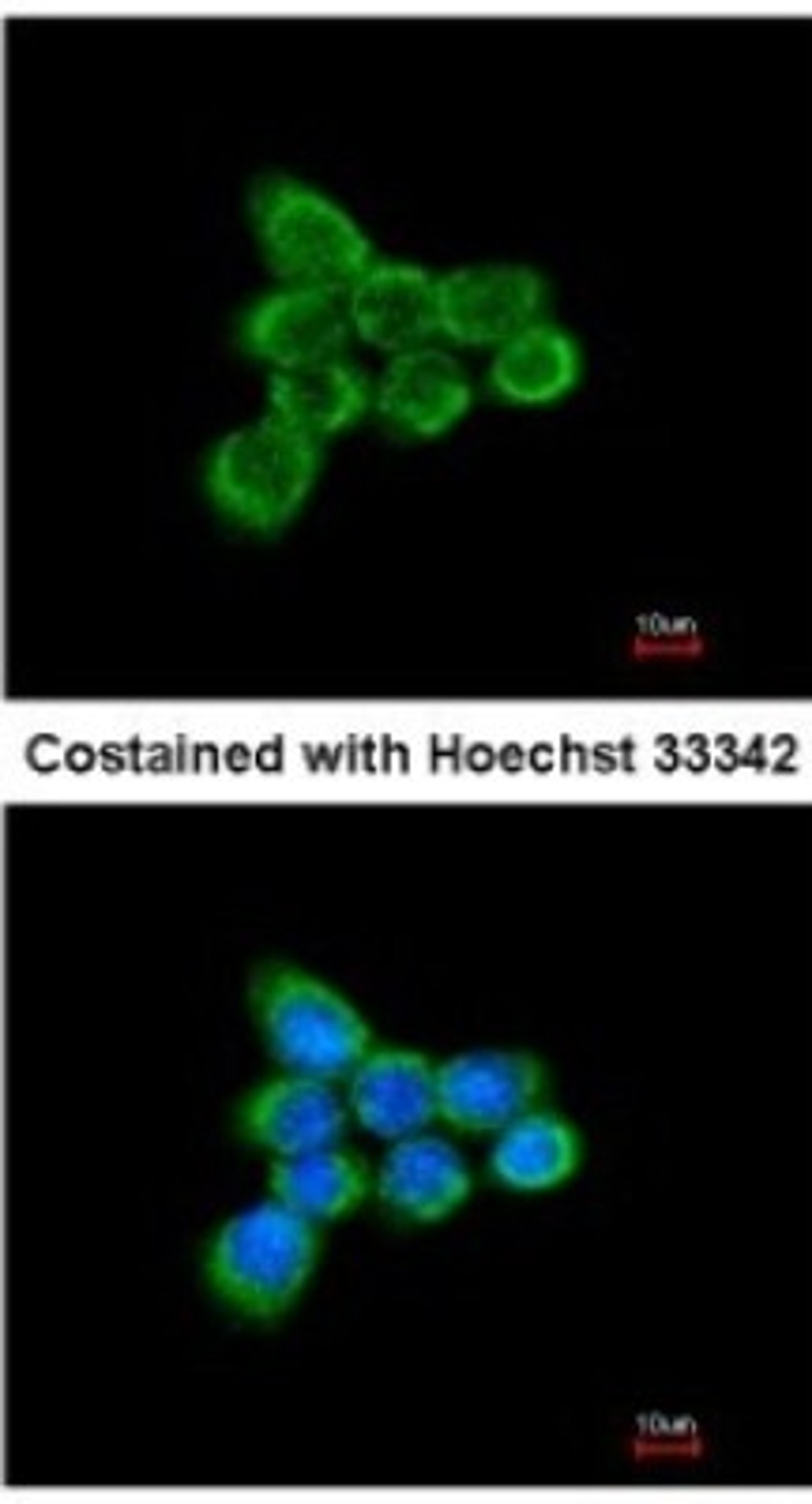 Immunocytochemistry/Immunofluorescence: NDUFAB1 Antibody [NBP1-31682] - Analysis of methanol-fixed A431, using antibody at 1:200 dilution.