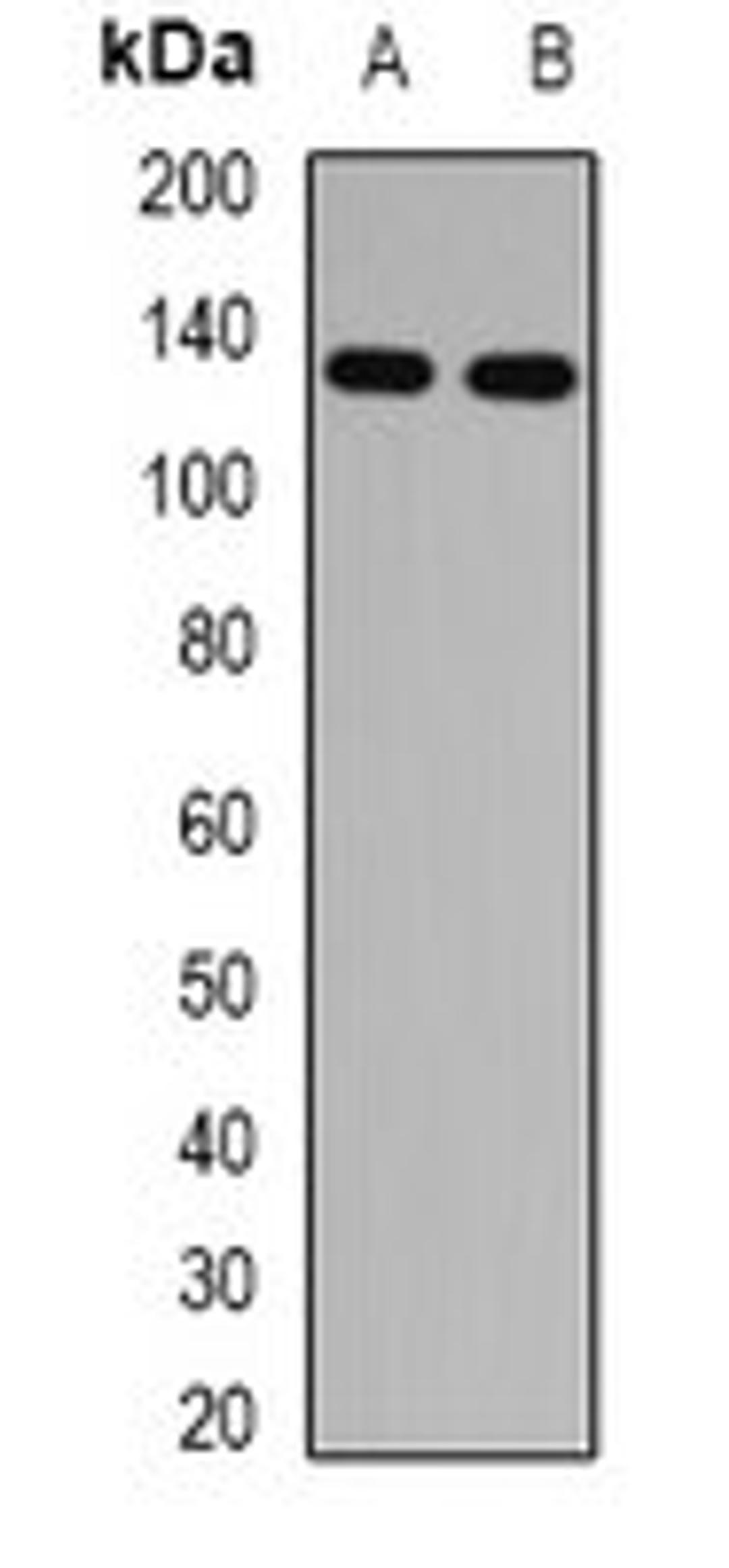 Western blot analysis of mouse lung (Lane1), rat eye (Lane2) whole cell lysates using RBP3 antibody