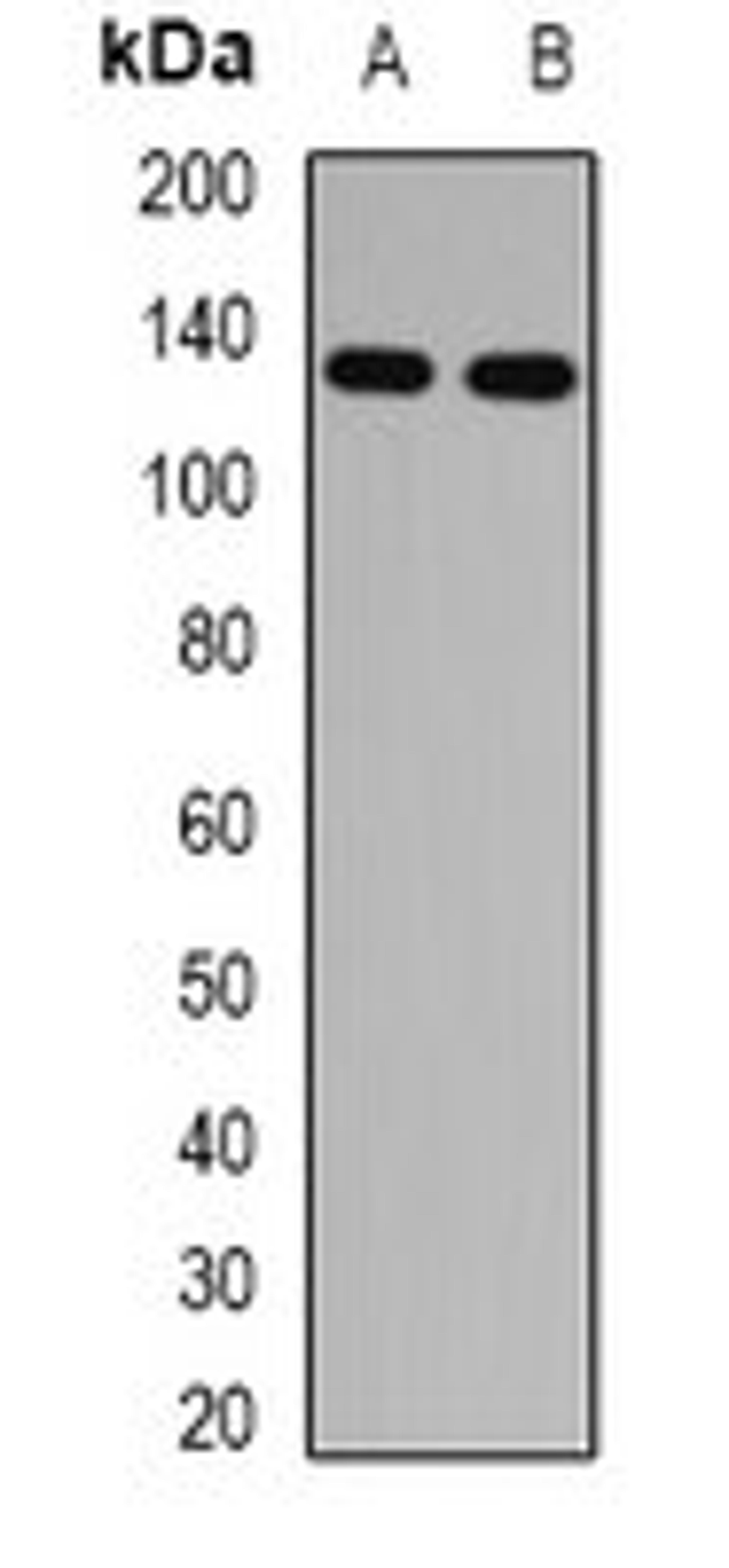 Western blot analysis of mouse lung (Lane1), rat eye (Lane2) whole cell lysates using RBP3 antibody