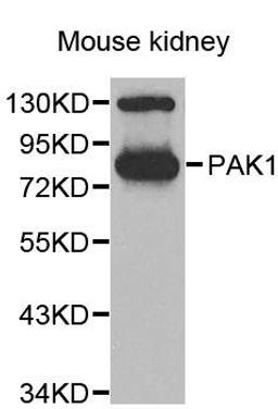 Western blot analysis of extracts of 293T cell line using PAK1 antibody