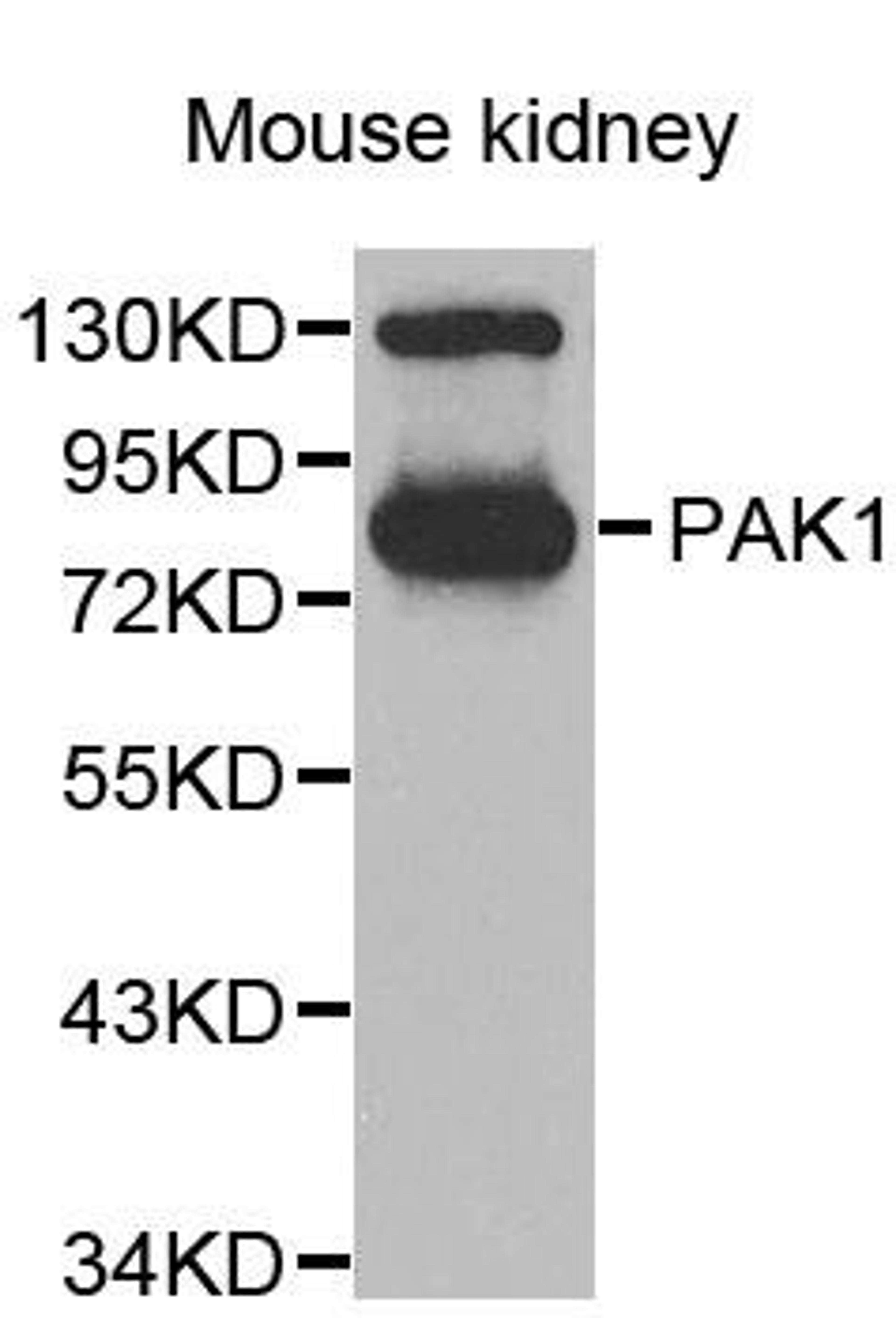 Western blot analysis of extracts of 293T cell line using PAK1 antibody