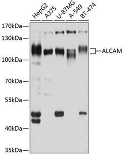 Western blot - ALCAM antibody (A2218)