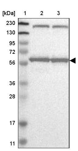 Western Blot: KPNA6 Antibody [NBP1-83762] - Lane 1: Marker [kDa] 230, 130, 95, 72, 56, 36, 28, 17, 11<br/>Lane 2: Human cell line RT-4<br/>Lane 3: Human cell line U-251MG sp