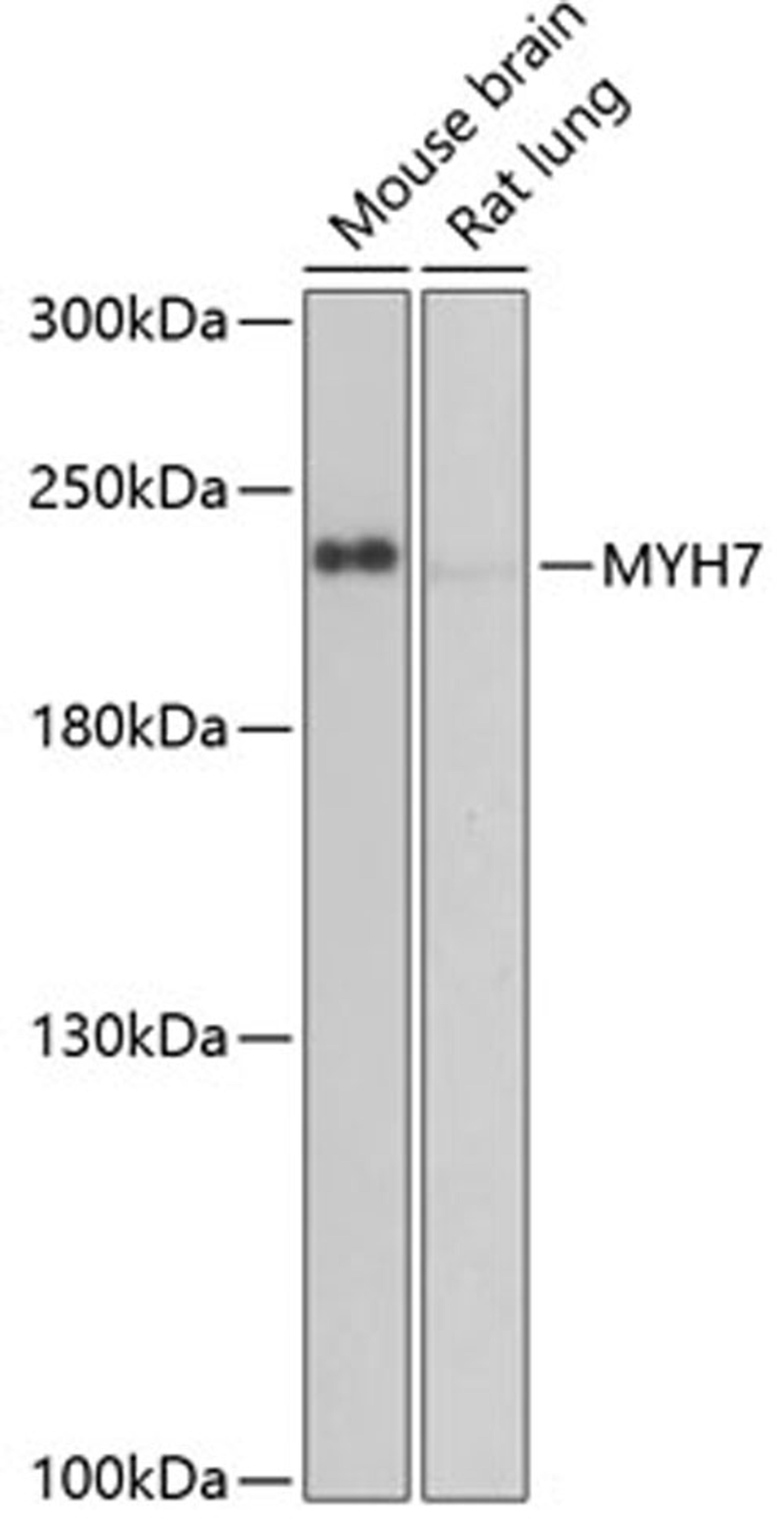 Western blot - MYH7 antibody (A7564)