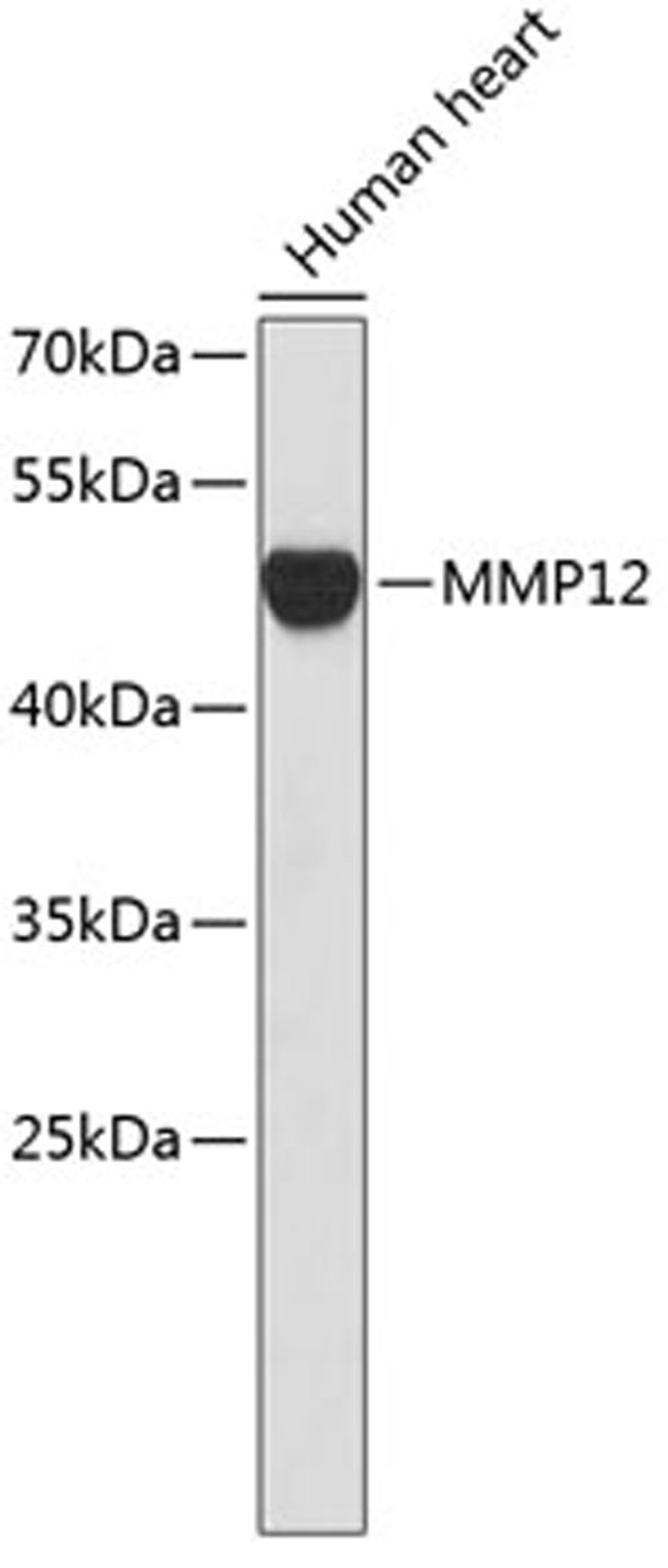 Western blot - MMP12 antibody (A1709)