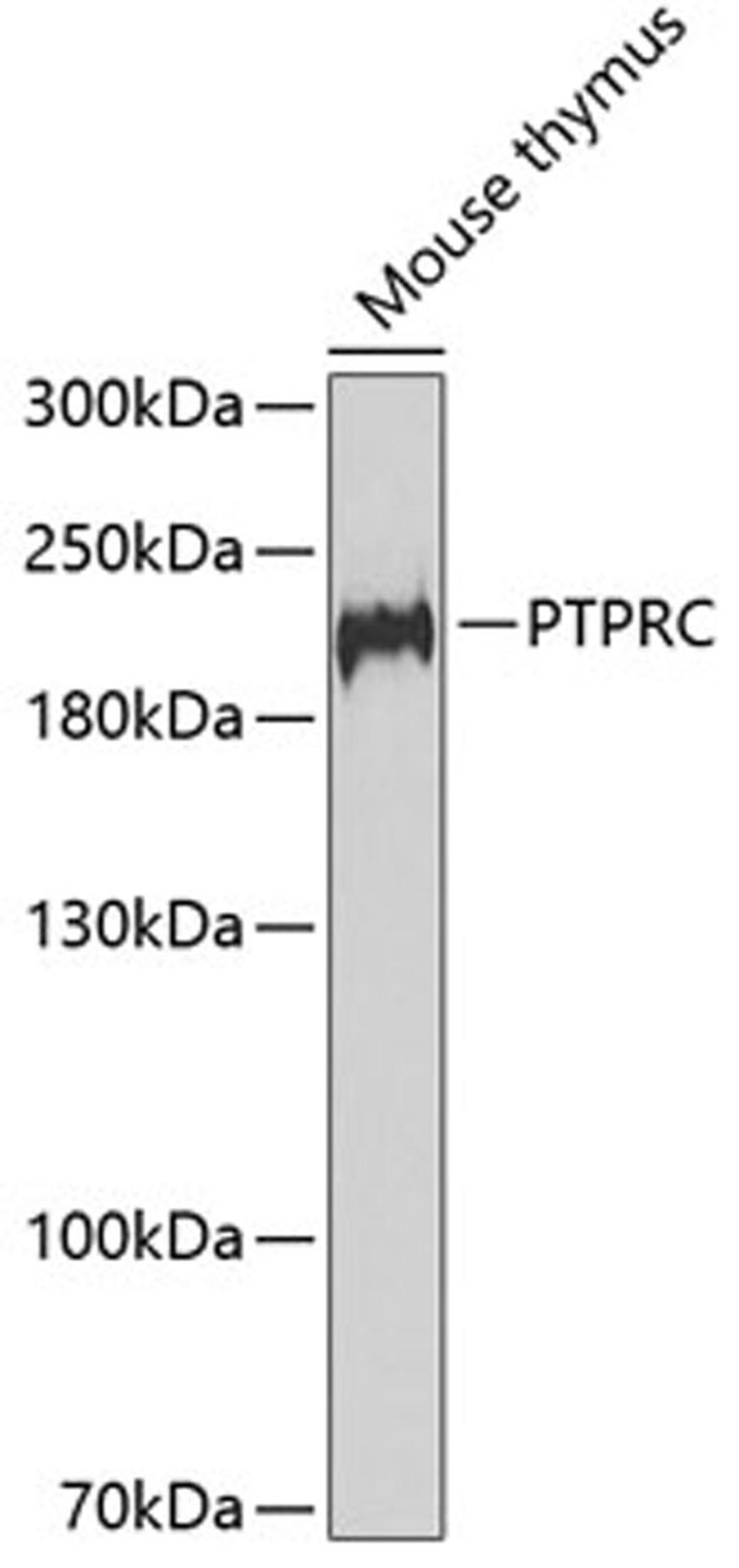 Western blot - PTPRC antibody (A2115)