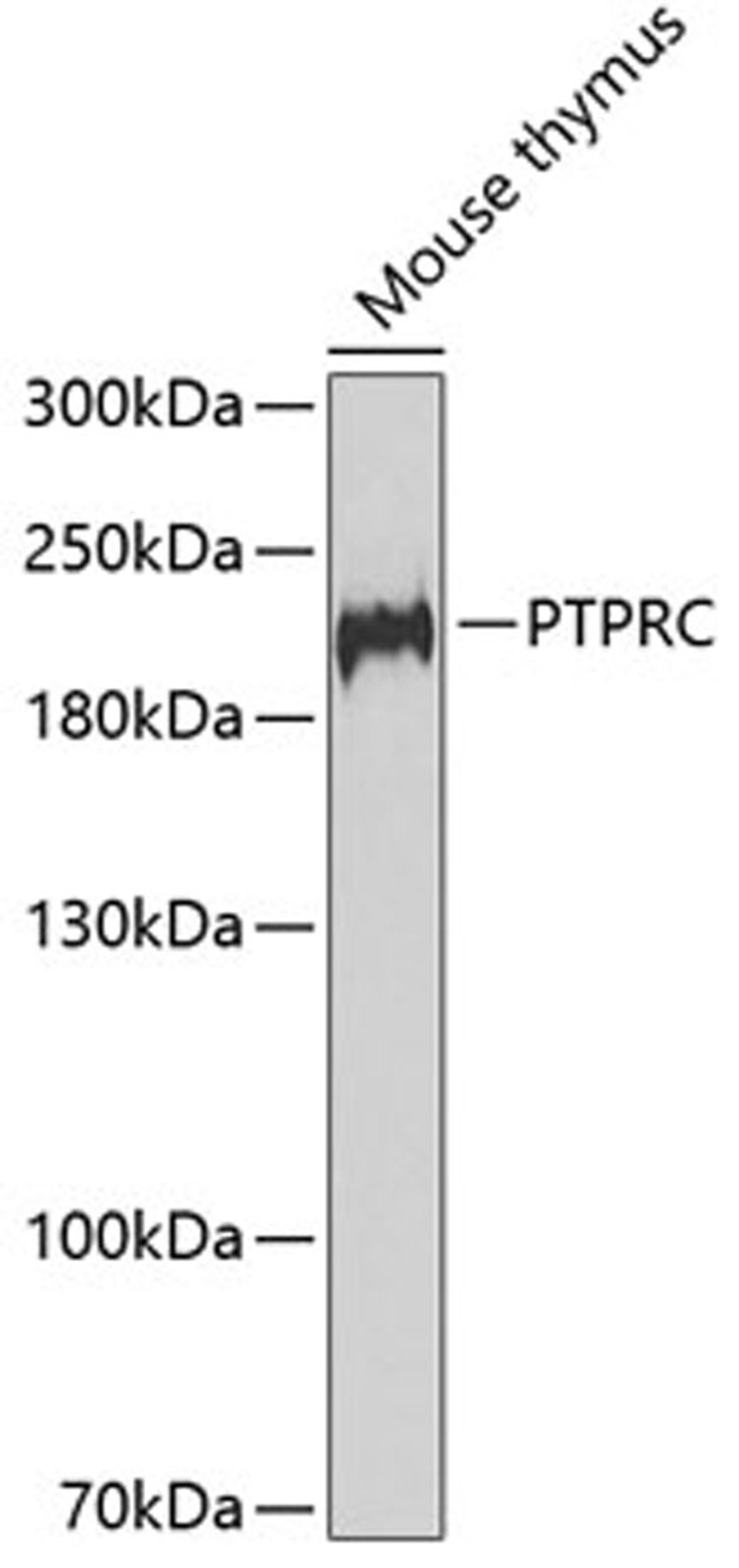 Western blot - PTPRC antibody (A2115)