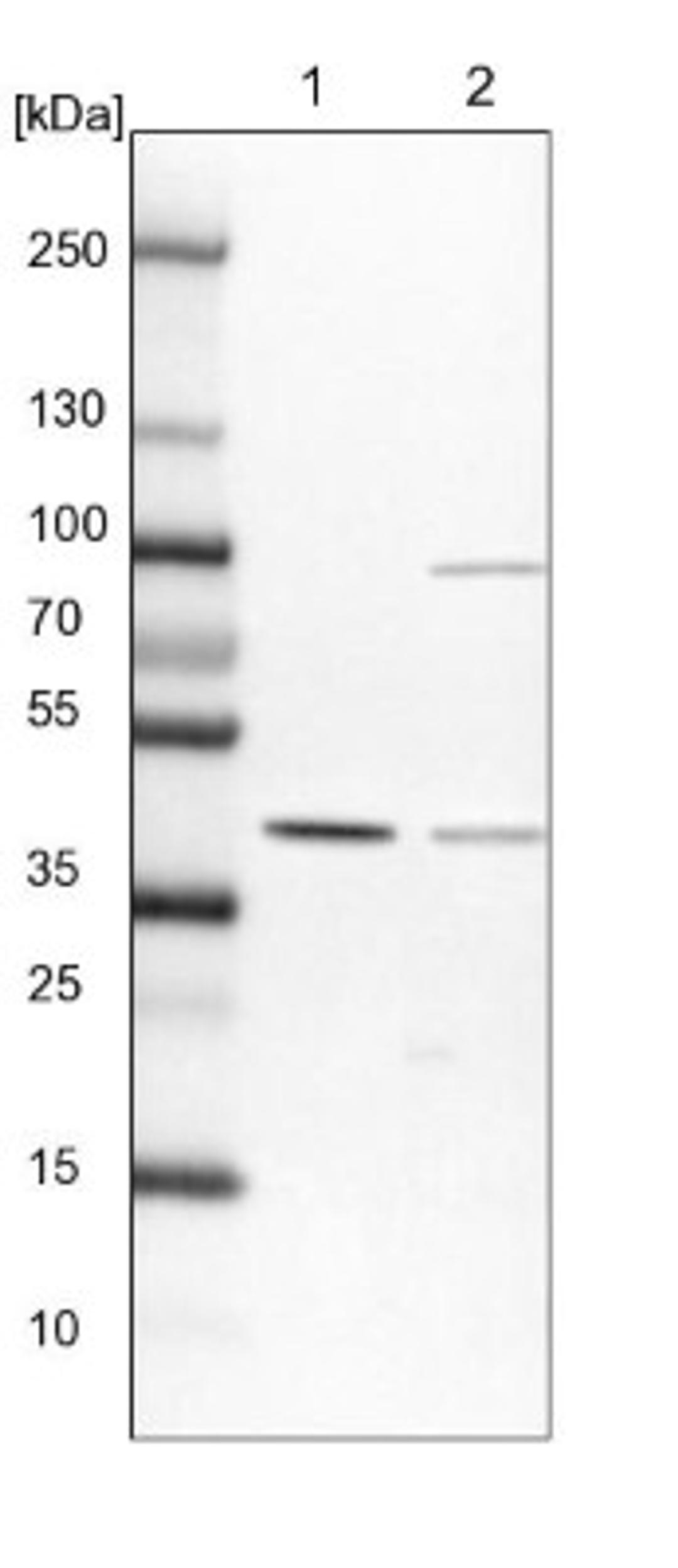 Western Blot: SFRS5 Antibody [NBP1-92381] - Lane 1: NIH-3T3 cell lysate (Mouse embryonic fibroblast cells)<br/>Lane 2: NBT-II cell lysate (Rat Wistar bladder tumour cells)