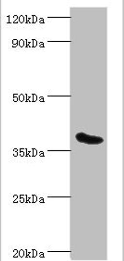 Western blot. All lanes: Phytanoyl-CoA dioxygenase, peroxisomal antibody at 3ug/ml + Mouse liver tissue. Secondary. Goat polyclonal to rabbit IgG at 1/10000 dilution. Predicted band size: 39, 28 kDa. Observed band size: 39 kDa. 