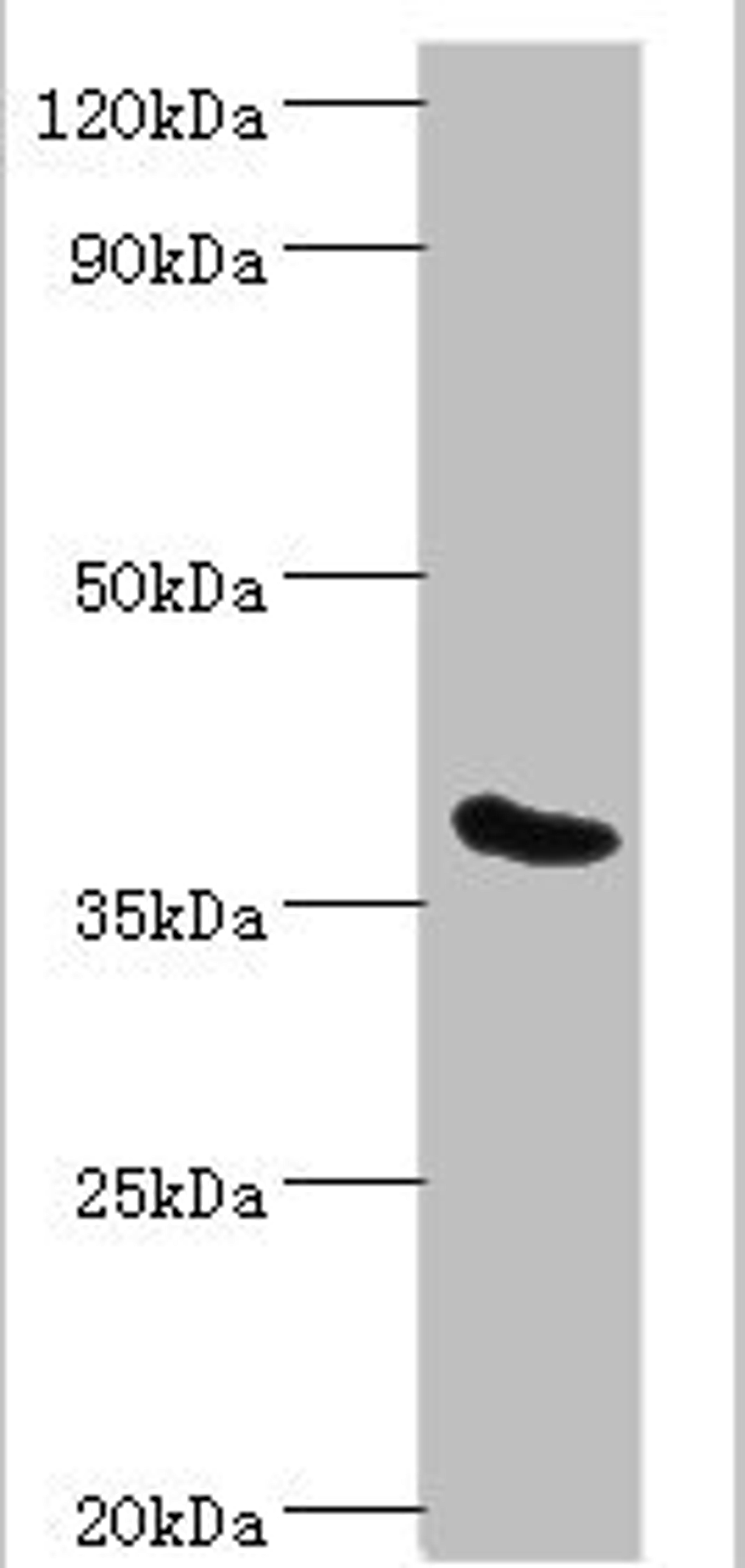 Western blot. All lanes: Phytanoyl-CoA dioxygenase, peroxisomal antibody at 3ug/ml + Mouse liver tissue. Secondary. Goat polyclonal to rabbit IgG at 1/10000 dilution. Predicted band size: 39, 28 kDa. Observed band size: 39 kDa. 