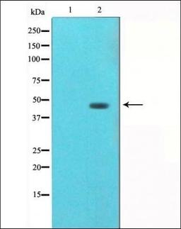 Western blot analysis of HUVEC whole cell lysate using AGER-RAGE- antibody