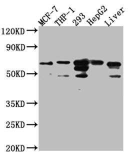 Western Blot. Positive WB detected in: MCF-7 whole cell lysate, THP-1 whole cell lysate, 293 whole cell lysate, HepG2 whole cell lysate, Mouse Liver whole cell lysate. All lanes: FAAH1 Antibody at 1:1000. Secondary. Goat polyclonal to rabbit IgG at 1/50000 dilution. Predicted band size: 64 kDa. Observed band size: 64 kDa.