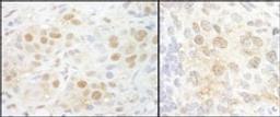 Detection of human and mouse NCBP2 by immunohistochemistry.