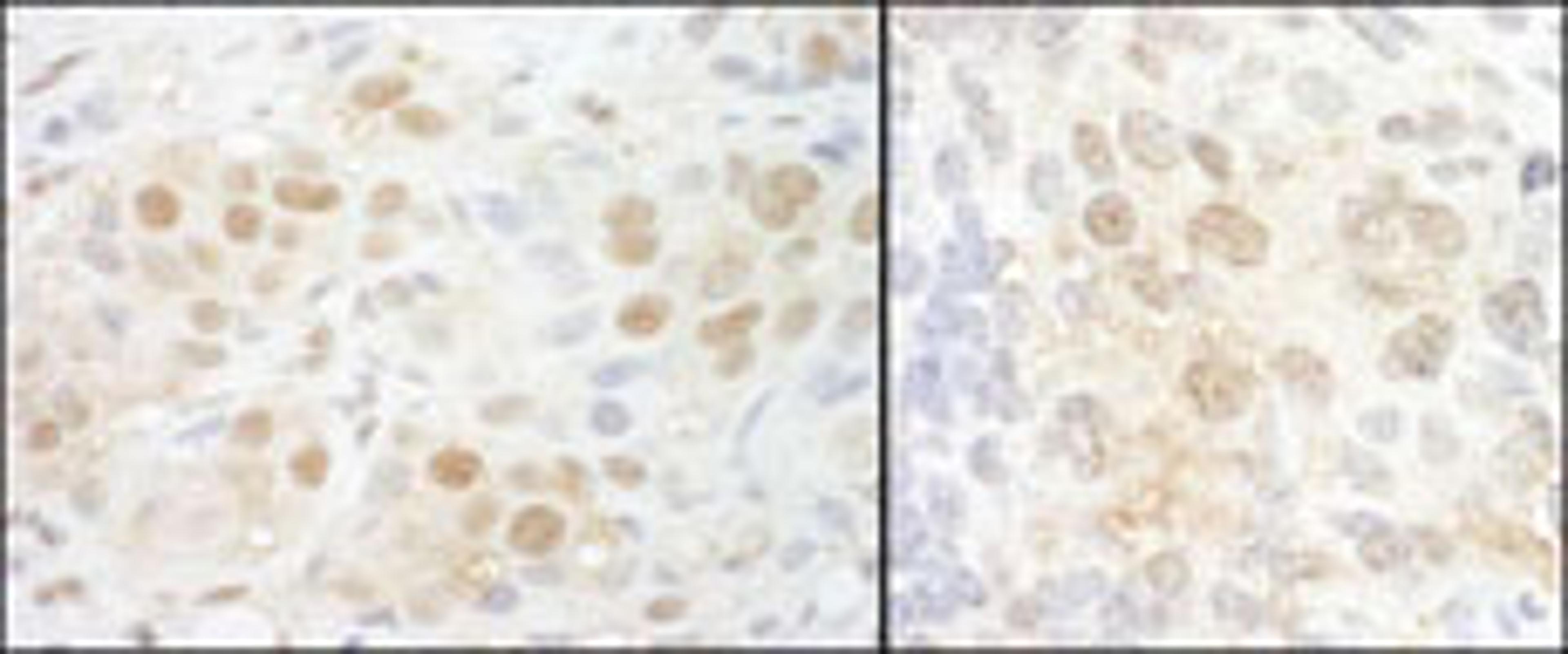 Detection of human and mouse NCBP2 by immunohistochemistry.