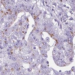 Immunohistochemistry: FAM43A Antibody [NBP2-31914] - testis cancer