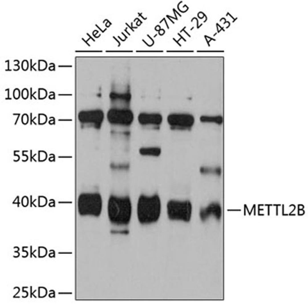 Western blot - METTL2B antibody (A12082)