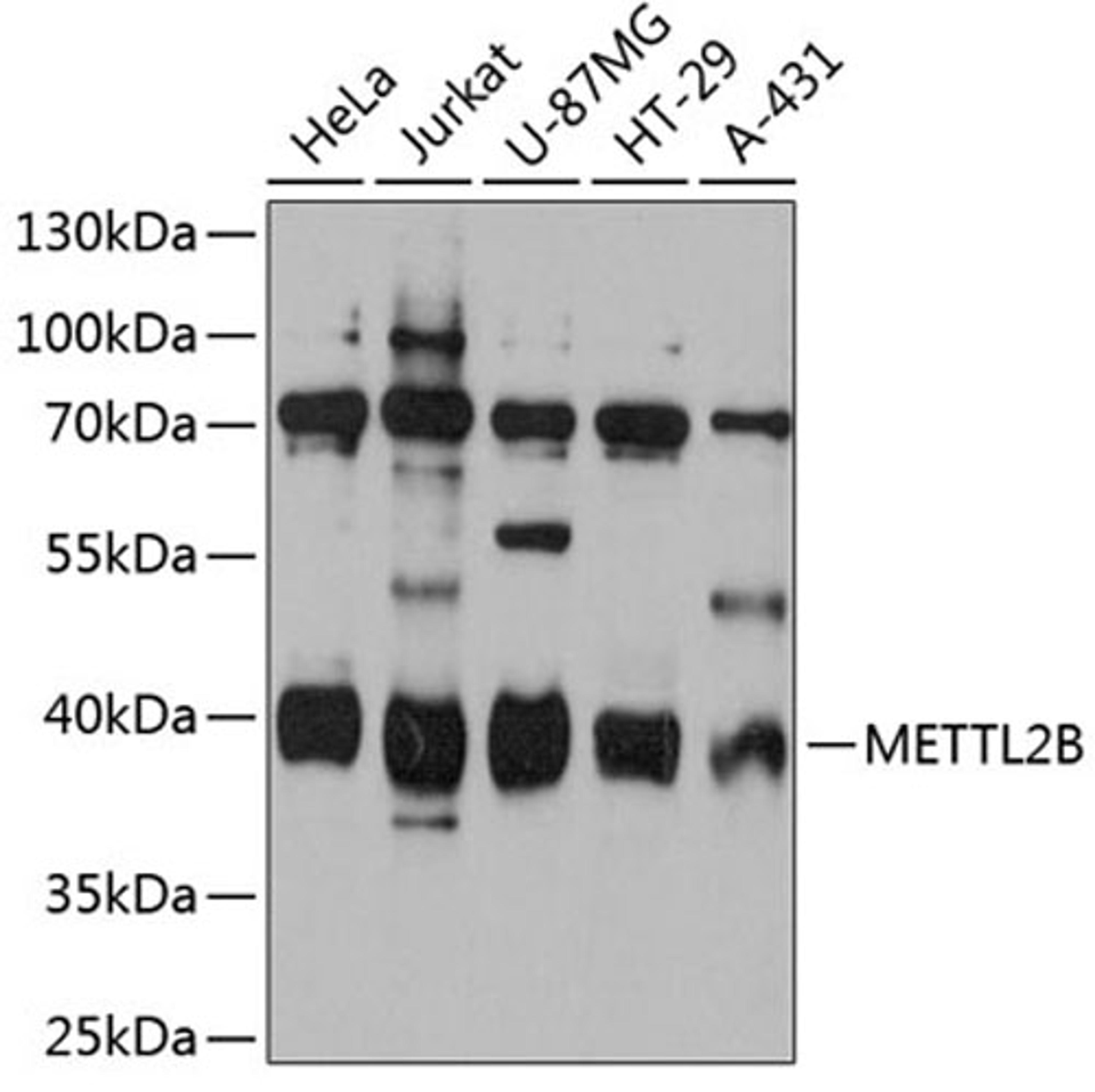 Western blot - METTL2B antibody (A12082)